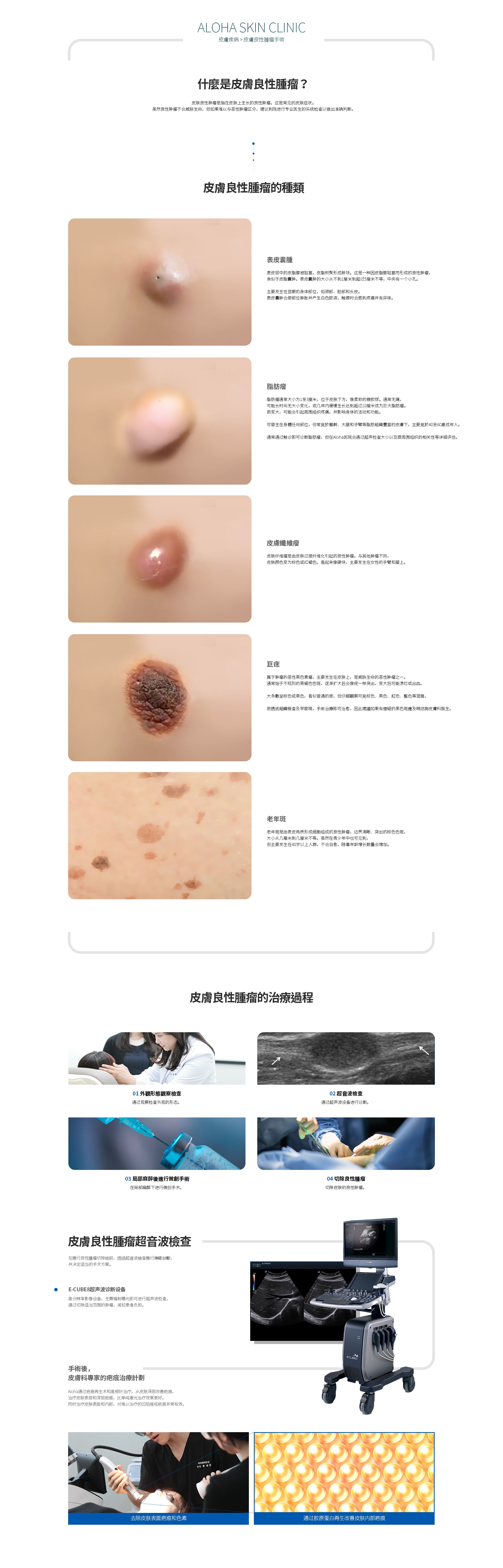 皮膚良性腫瘤手術